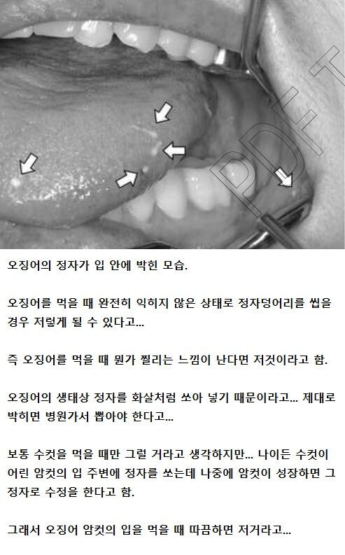 [혐주의] 여성 입 안에 박힌 정자