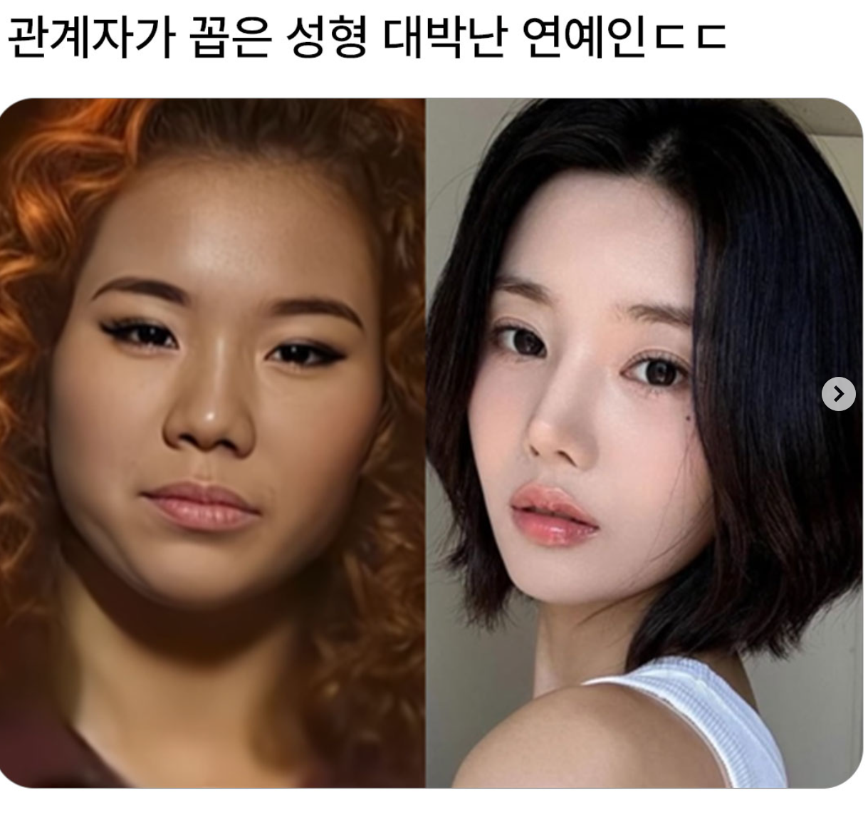 관계자가 꼽은 성형 대박난 연예인 ㄷ ㄷ