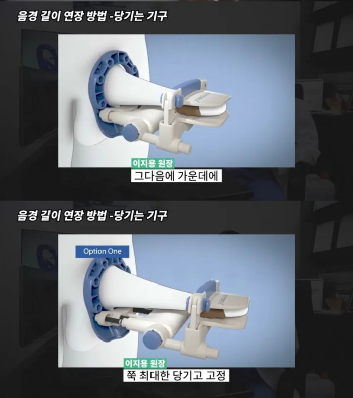 수술없이 꼬추길이 늘리는법