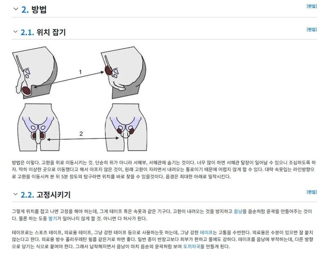 Screenshot_20250819_130513.jpg 여장러들이 고환을 감추는 법