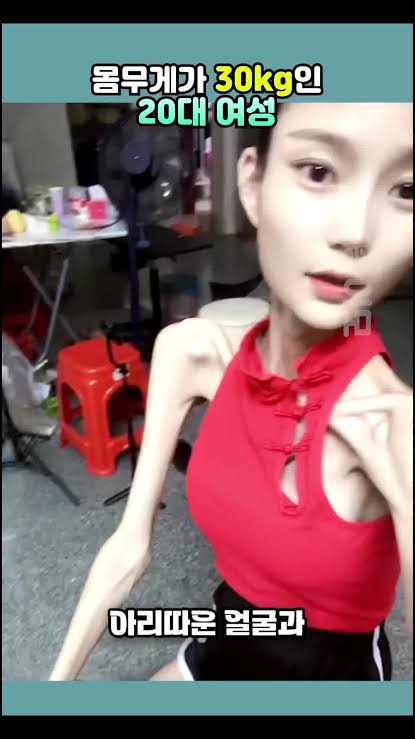 images (4).jpeg 몸무게가 30kg인 20대여성